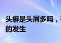 头癣是头屑多吗，有什么症状，如何预防头癣的发生